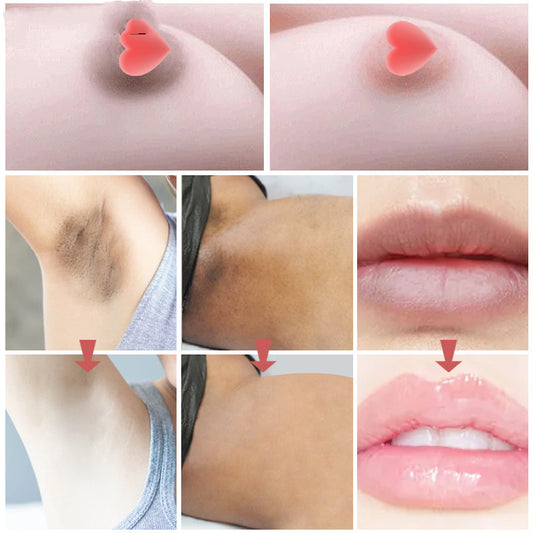 Intimate Area Rose Skin Pigmentation 30G